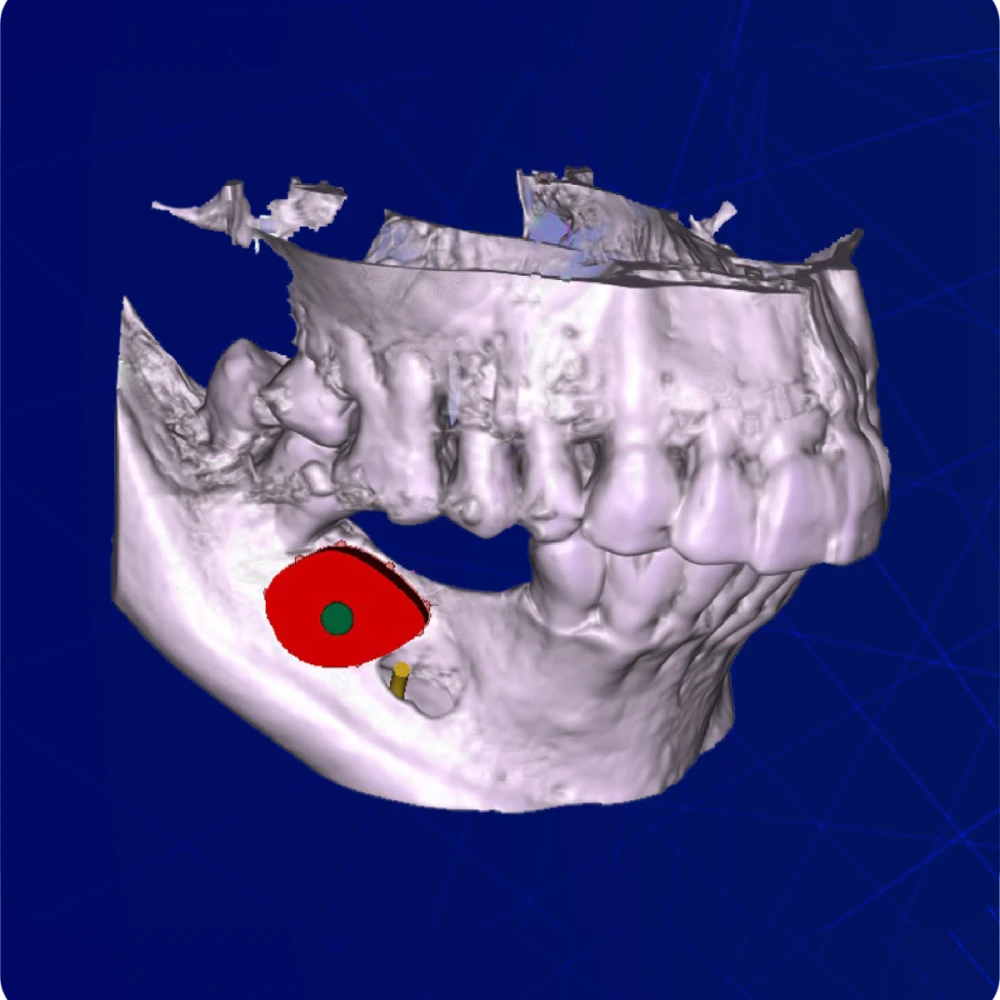 Cad Model
